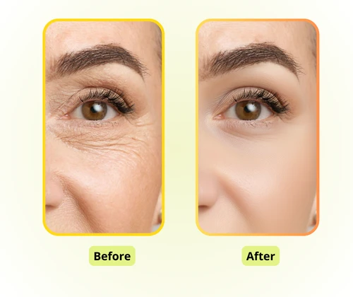 Удалитель морщин с ИИ: Эффективная ретушь фото для создателей контента